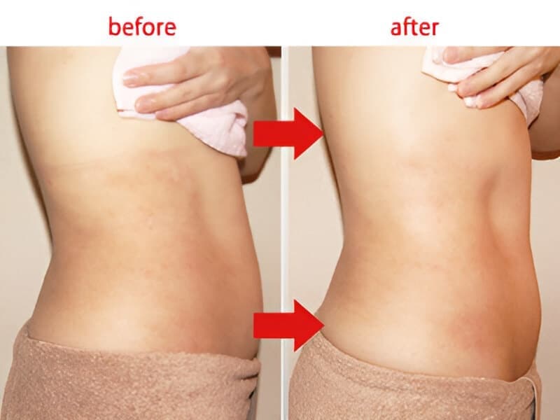 ボディ施術結果