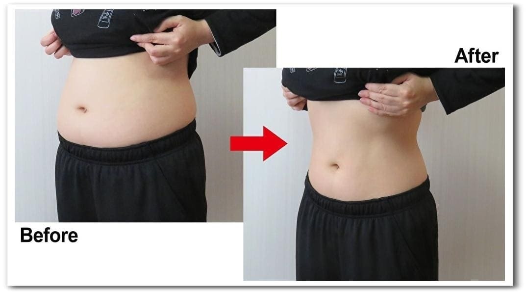 筋膜矯正・筋膜リリースの体型変化